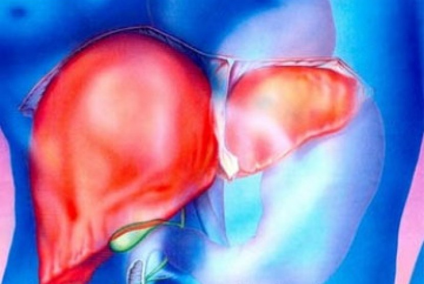 RSCM Kembali Sukses Lakukan Transplantasi Hati pada Pasien Dewasa